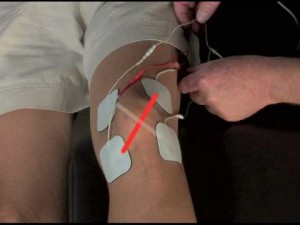 TENS Electrode Placement